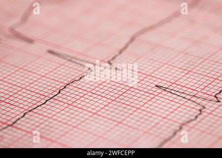 Close up of an electrocardiogram in paper form Stock Photo