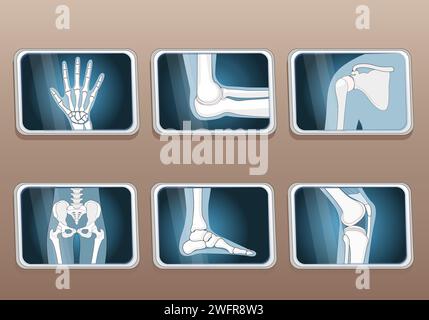 Types of joints. Knee, Elbow, wrist, hip, shoulder joints and Articulations of foot. Set icons. X-ray image. Isometric Flat vector illustration. Stock Vector