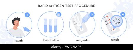 Covid-19 Rapid Antigen test procedure Infographic. A doctor takes nasal swab from male patient. Coronavirus swap sample in lysis buffer, strip with re Stock Vector