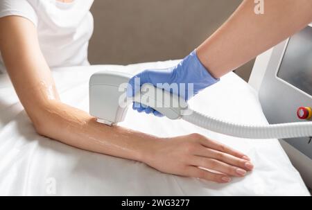 Laser hair removal of hands in a beauty salon. Hand hair removal procedure using laser hair removal technology. Stock Photo