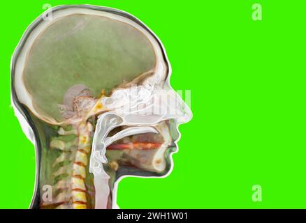 Head and neck structures, CT scan Stock Photo