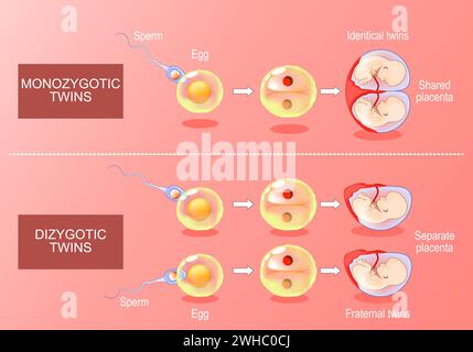 Zygote development in monozygotic and dizygotic twins. From Fertilization, egg plus sperm to amniotic sacs formation. Isometric Vector. Flat illustrat Stock Vector