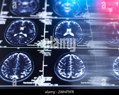 Brain research, conceptual image Stock Photo