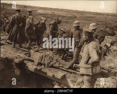 Canadian wounded soldiers, and German prisoners waiting to be loaded on the light railway trucks,   Images from Canadian Forces in First World War France 1917 Stock Photo