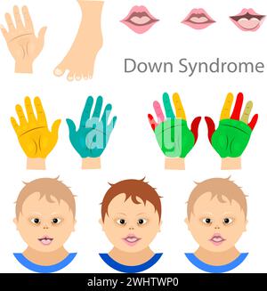 World Down syndrome day. Signs of Down syndrome. Down syndrome awareness concept. Vector Illustration Stock Vector