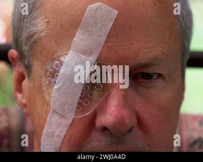 A transparent eye shield is taped over a man's eye to protect it while it heals from IOL surgery. Stock Photo