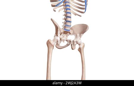 Intertrochanteric fracture on the femur head skeleton 3D medical illustration Stock Photo