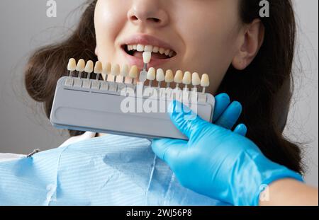 Dentist choosing color of tooth enamel for patient. Dentist applying sample from tooth enamel scale to caucasian female teeth Stock Photo