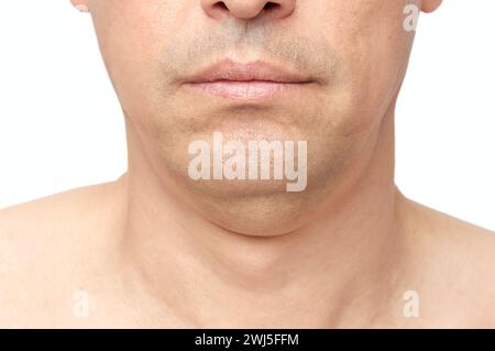 Man a double fat chin, a problem with a hanging chin with white background Stock Photo