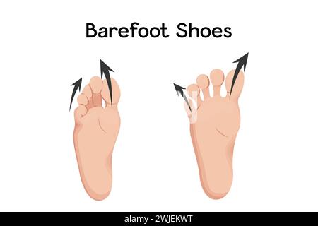 Compare feet before and after barefoot shoes vector illustration ...