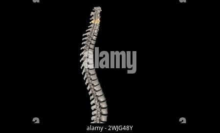 The fourth cervical vertebra (C4) is centrally located in the cervical ...