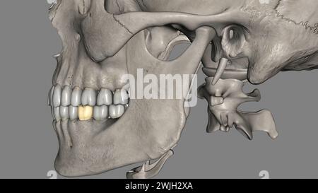 The mandibular first molar usually has two roots, a mesial and a distal ...