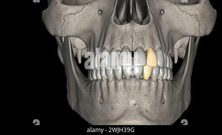 Lateral Incisor, Maxillar and Mandibular 3d illustration Stock Photo ...