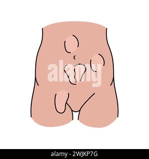 Hernias line icon. Vector isolated element. Editable stroke. Stock Vector