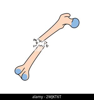 Open bone fracture line icon. Vector isolated element. Editable stroke. Stock Vector