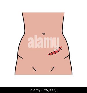 Rutherford morrison incision line icon. Abdominal incisions. Vector ...