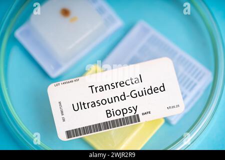 Transrectal ultrasound-guided biopsy Stock Photo