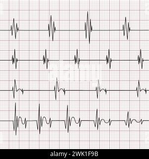 Multiple EKG (Electrocardiogram) graphs on a grid background. Various heart rhythms and cardiac conditions analysis. Monitoring heart health. Vector Stock Vector