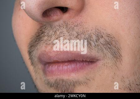 Caucasian male with uneven stubble, unshaven, close up shot, unrecognizable, no eyes. Stock Photo