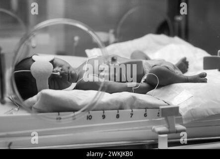 Premature Baby Unit at Nottingham General Hospital, NHS 1980s UK. A new born premature baby in an incubator being monitored. Nottingham, Nottinghamshire, England circa 1980s. Stock Photo