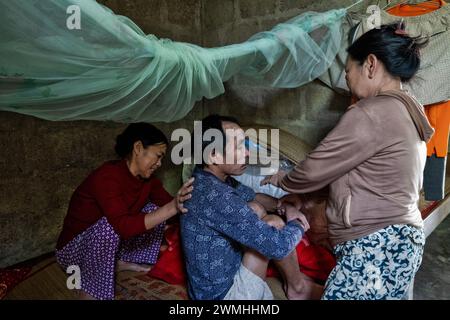 Agent Orange victims in Vietnam, dioxine pollution Stock Photo