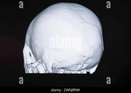 Human skull CT scans Stock Photo