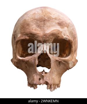 An Ancient Human Skull Preserved For Medical Science, Isolated On A White Background Stock Photo