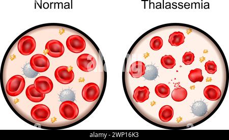 Red blood cell and hemoglobin. Close-up of Hemoglobin molecule with ...