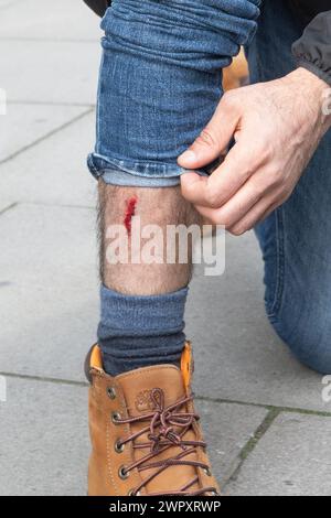 Victoria, London, UK. 9th March 2024. London based Iranin, Niyak Ghorbani, was arrested at todays Pro Palestine march by the Metropolitan Police after he was assaulted by several protesters for displaying a banner reading “Hamas is terrorist”  Mr Ghorbani received a cut to his shin in the attack. Photo by Amanda Rose/Alamy Live News Stock Photo