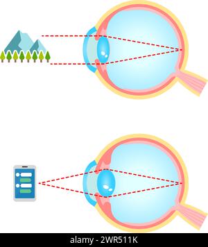 Mechanism of eyeball for looking far and near. Vector illustration. Stock Vector