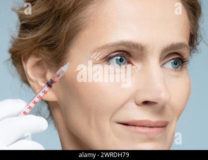 Biorevitalization procedure. Middle-aged woman while beauty injections with hyaluronic acid for smoothing of mimic wrinkles around eyes, portrait Stock Photo