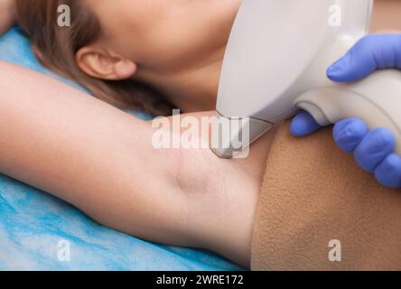 The cosmetologist does the laser hair removal procedure in the armpit zone, to a young woman in a beauty salon. Stock Photo