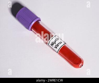 Picture on a white background with a test tube full of blood that is sick with the Nipah virus. Stock Photo