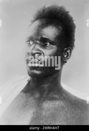 Wounded &quot;French&quot; prisoner of Germans, between c1910 and c1915. Shows a African soldier, probably a Senegalese tirailleur (infantry soldier fighting for the French forces), who was taken prisoner by German forces during World War I. Stock Photo