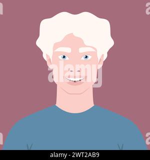 Beautiful happy Albino man portrait. Avatar of a young African male with albinism. Genetic rare appearance. Vector illustration Stock Vector