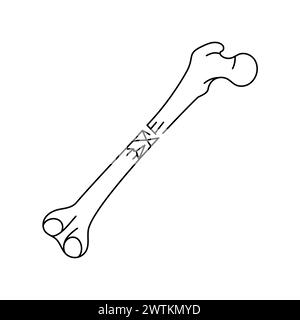 Communuted bone fracture line icon. Vector isolated element. Editable stroke. Stock Vector