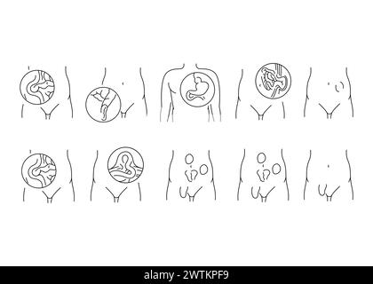 Hernias line icons set. Vector isolated element. Editable stroke. Stock Vector