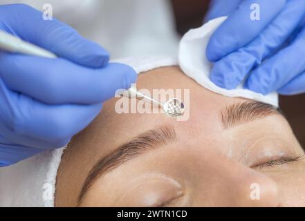 Procedure for cleaning the skin of the face with a steel appliance with a spoon from blackheads and acne. Stock Photo