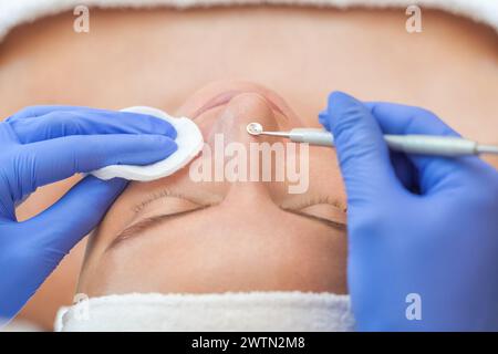 Procedure for cleaning the skin of the face with a steel appliance with a spoon from blackheads and acne. Stock Photo