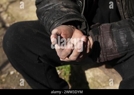 Poor homeless man with dirty hands outdoors, closeup Stock Photo