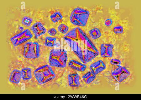 Calcium oxalates (ionic crystal which is involved in nearly 80% of the composition of kidney stones). Optical microscopy. Stock Photo