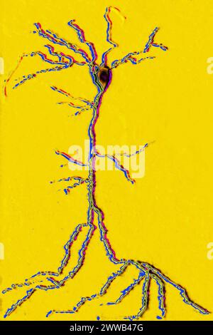Multipolar neuron (basic cell of nervous tissue, receiving, analyzing and producing information). Stock Photo