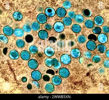 Colorized transmission electron micrograph of monkeypox particles (teal) found within an infected cell (brown), cultured in the laboratory. Stock Photo