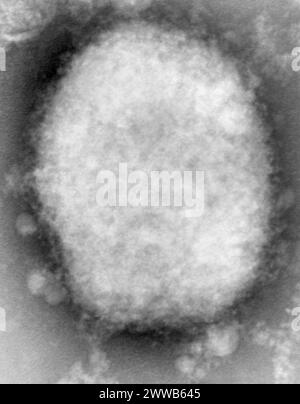 This highly magnified negative spot transmission electron micrograph (TEM) image reveals a type M monkeypox virus, or mulberry. Stock Photo