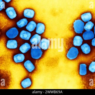 Colorized transmission electron micrograph of monkeypox virus particles (blue) cultivated and purified from cell culture. Stock Photo