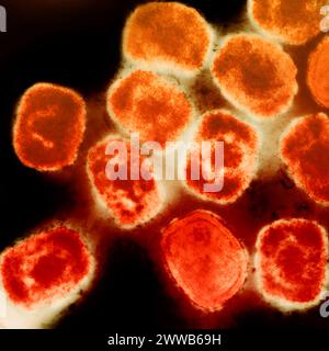 Colorized transmission electron micrograph of monkeypox virus particles (orange) cultivated and purified from cell culture. Stock Photo