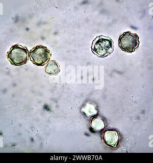 Acanthamoeba is a microscopic, free-living amoeba, or amoeba (single ...