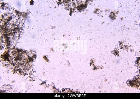 This photomicrograph of an unstained specimen revealed the presence of ...