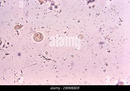 Under 500X magnification, this photomicrograph of a direct mount ...
