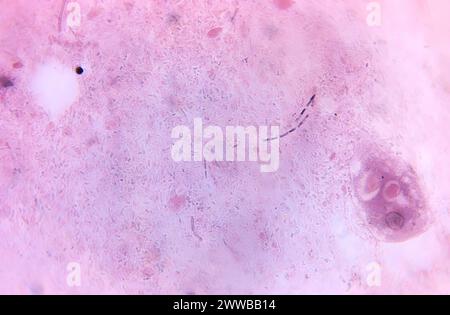 Under 675X magnification, this photomicrograph revealed the presence of ...